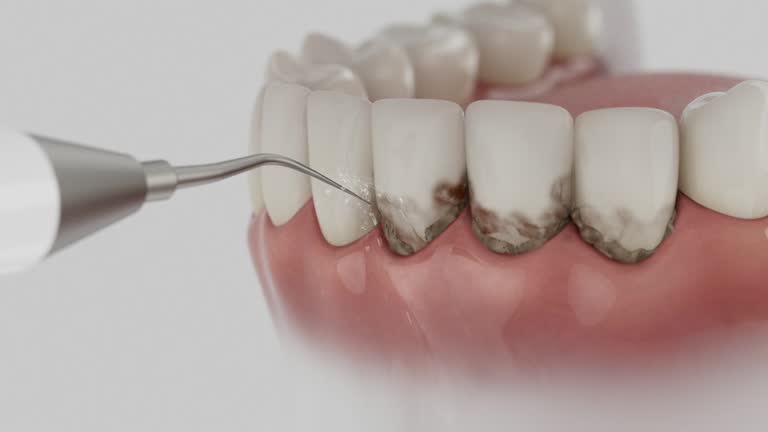 Reliable Dental Implants contractor in Moweaqua, IL by Smile Center Dentistry